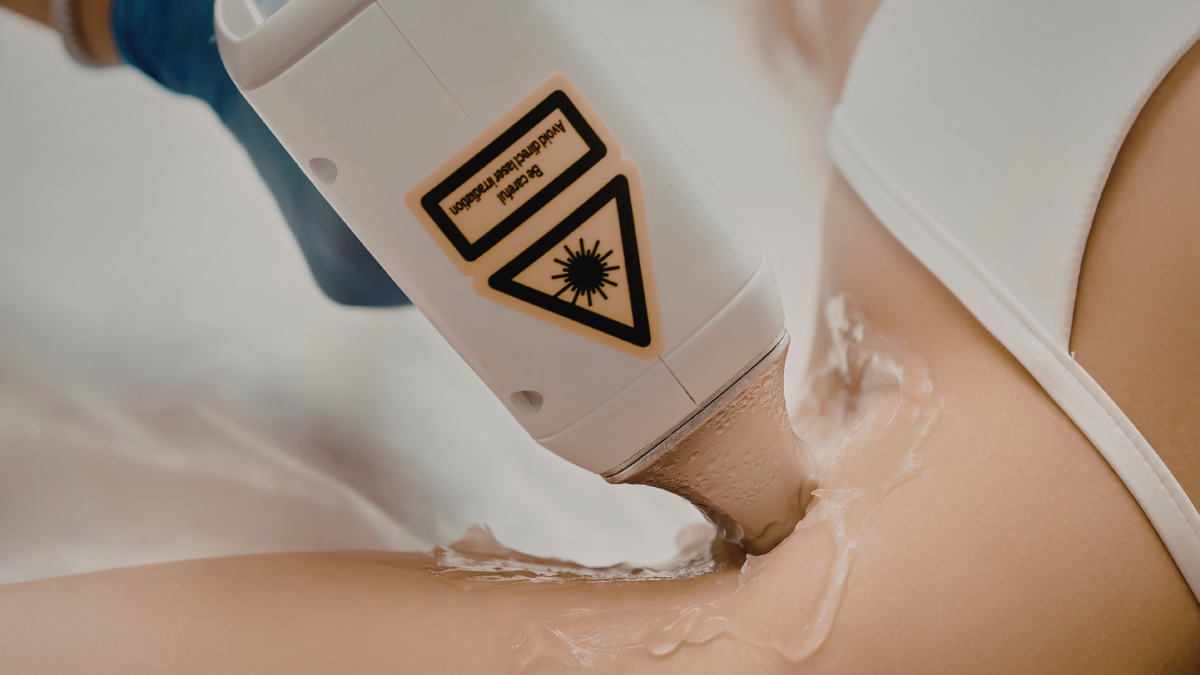 Depilacja laserowa pach, przyłožona głowica