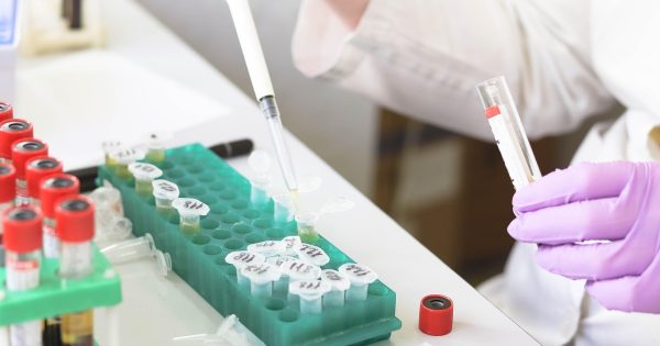 Wysokiej klasy akcesoria laboratoryjne dla profesjonalistów